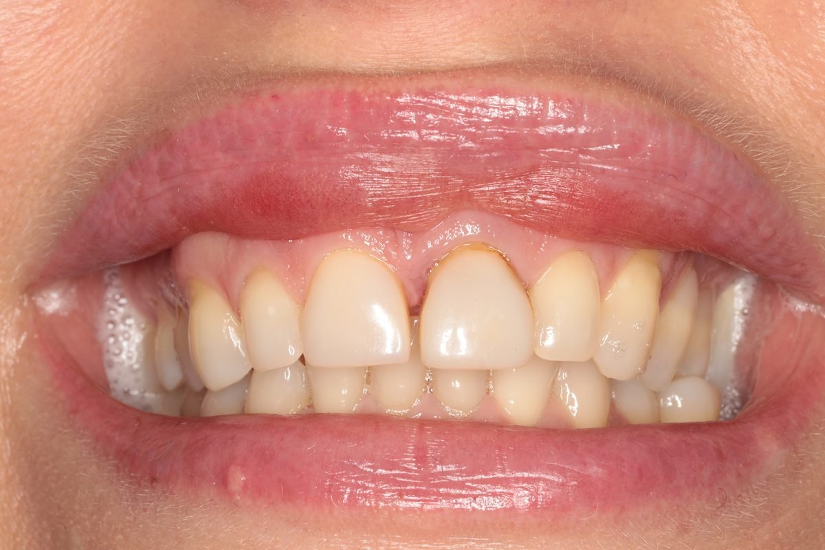 Clinical case before treatment